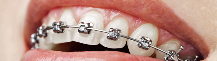 Mary Lo Consultant Orthodontist