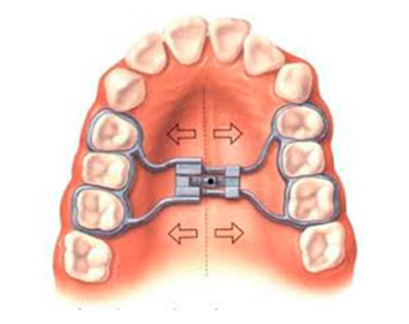 Mary Lo, Consultant Orthodontist Treatments